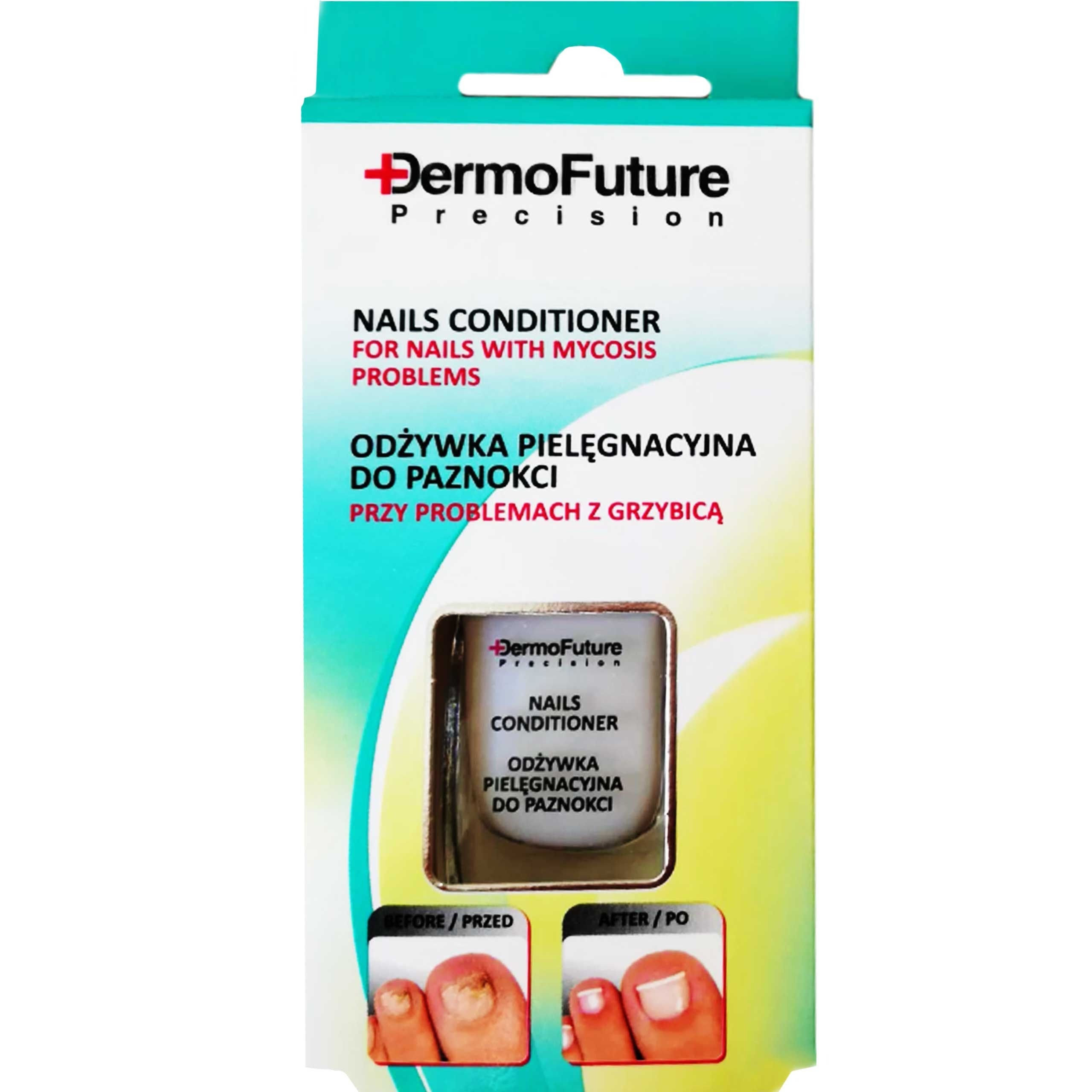 Image of DermoFuture - terapia przeciw grzybicy paznokci, wspomagająca leczenie, 9ml