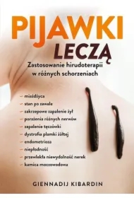 Pijawki leczą. Zastosowanie hirudoterapii...