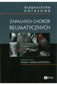 Diagnostyka obrazowa zapalnych chorób..