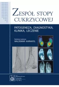 Zespół stopy cukrzycowej. Patogeneza, diagnostyka, klinika, leczenie