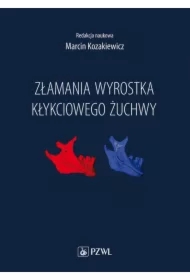 Złamania wyrostka kłykciowego żuchwy