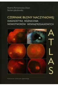 Czerniak błony naczyniowej. Diagnostyka różnicowa