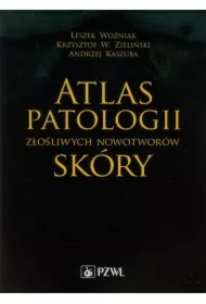 Atlas patologii złośliwych nowotworów skóry