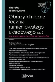 Obrazy kliniczne tocznia rumieniowatego układowego. Część 2. Na podstawie opisów przypadków. Choroby reumatyczne. W gabinecie lekarza specjalisty