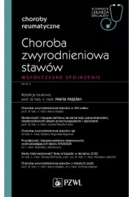 Choroba zwyrodnieniowa stawów. Współczesne spojrzenie. Choroby reumatyczne. W gabinecie lekarza specjalisty