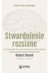 Stwardnienie rozsiane