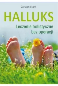 Halluks. Leczenie holistyczne bez operacji