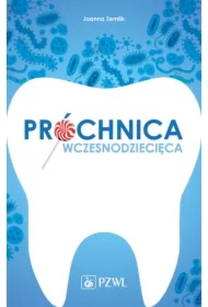 Próchnica wczesnodziecięca