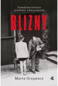 Blizny. Prawdziwa historia "królików" z Ravensbruck