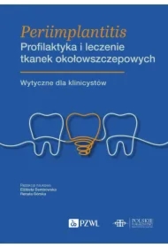 Periimplantitis. Profilaktyka i leczenie tkanek okołowszczepowych
